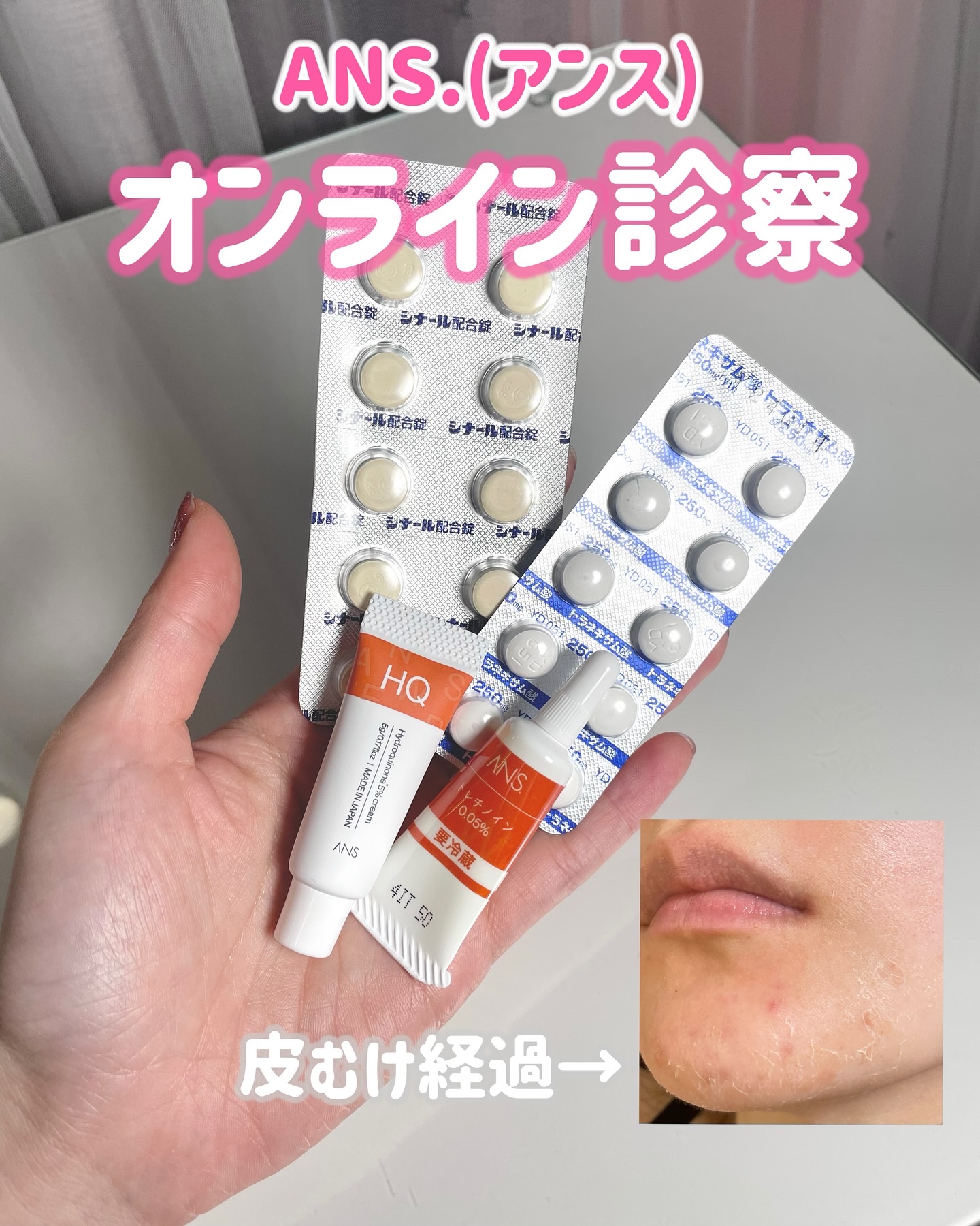 トラネキサム酸錠/ANS./その他を使ったクチコミ（1枚目）