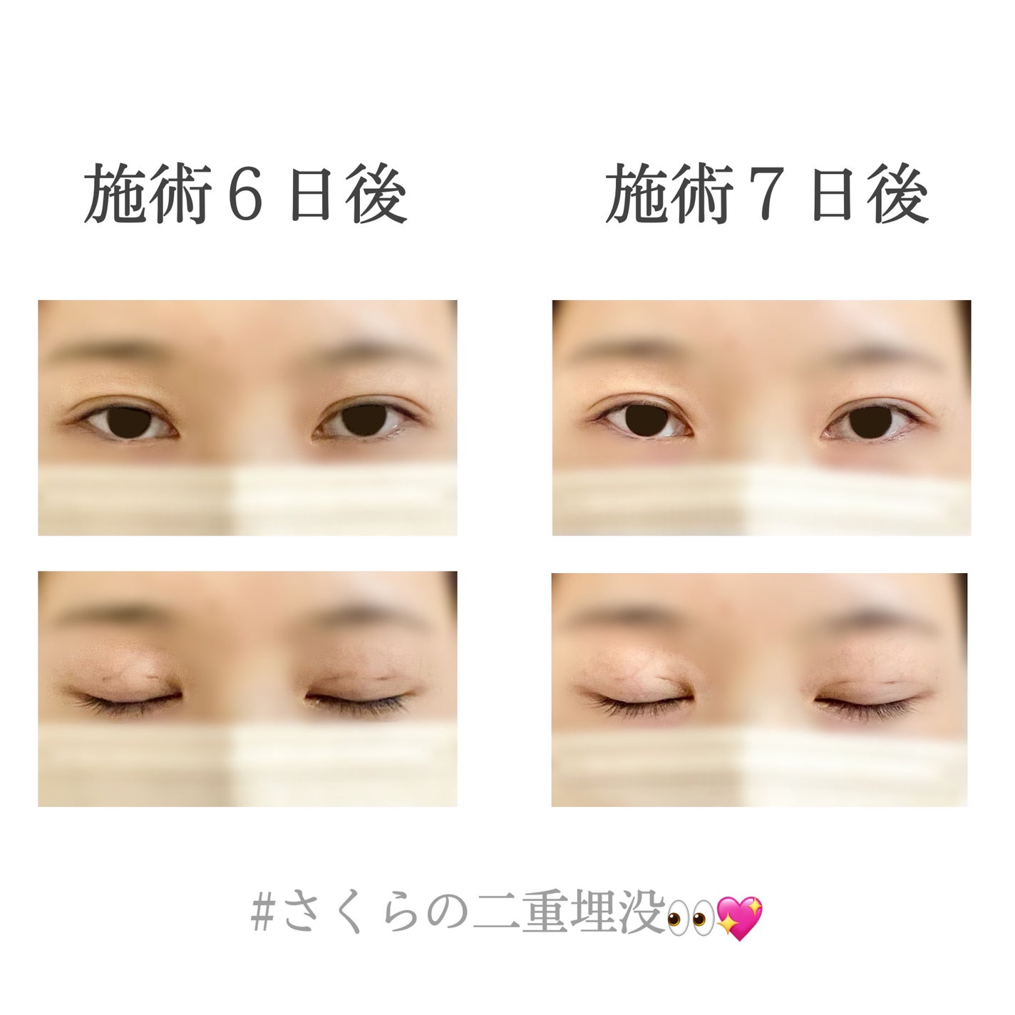 ãããðž on LIPS ãäºéåæ²¡äœéšèšâ¢ðð(æœè¡ç¿æ¥ã10æ¥åŸ)----------..ãïŒ6æç®ïŒ