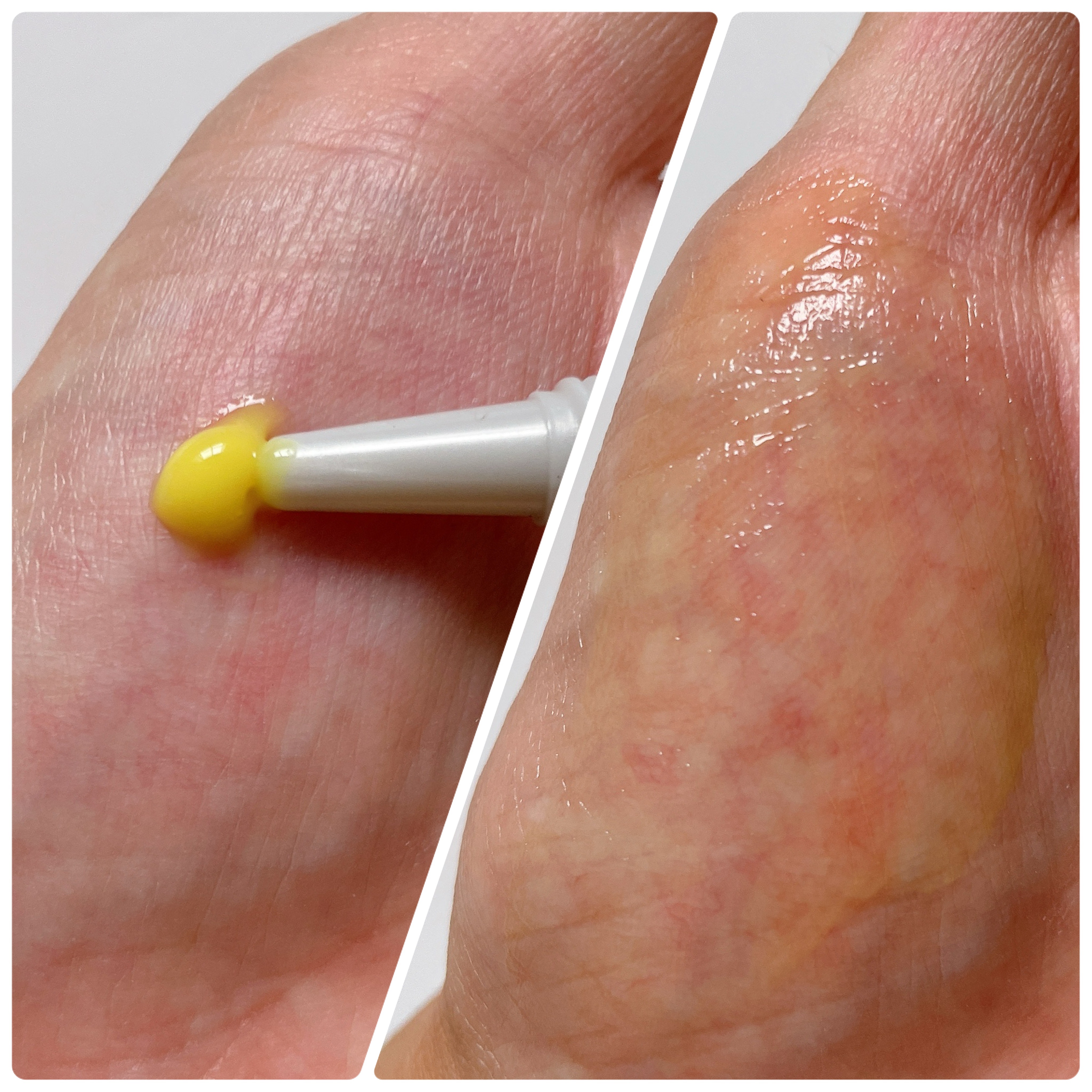 THE ビタA レチナールショット タイトニングブースター/celimax/ブースター・導入液を使ったクチコミ（2枚目）