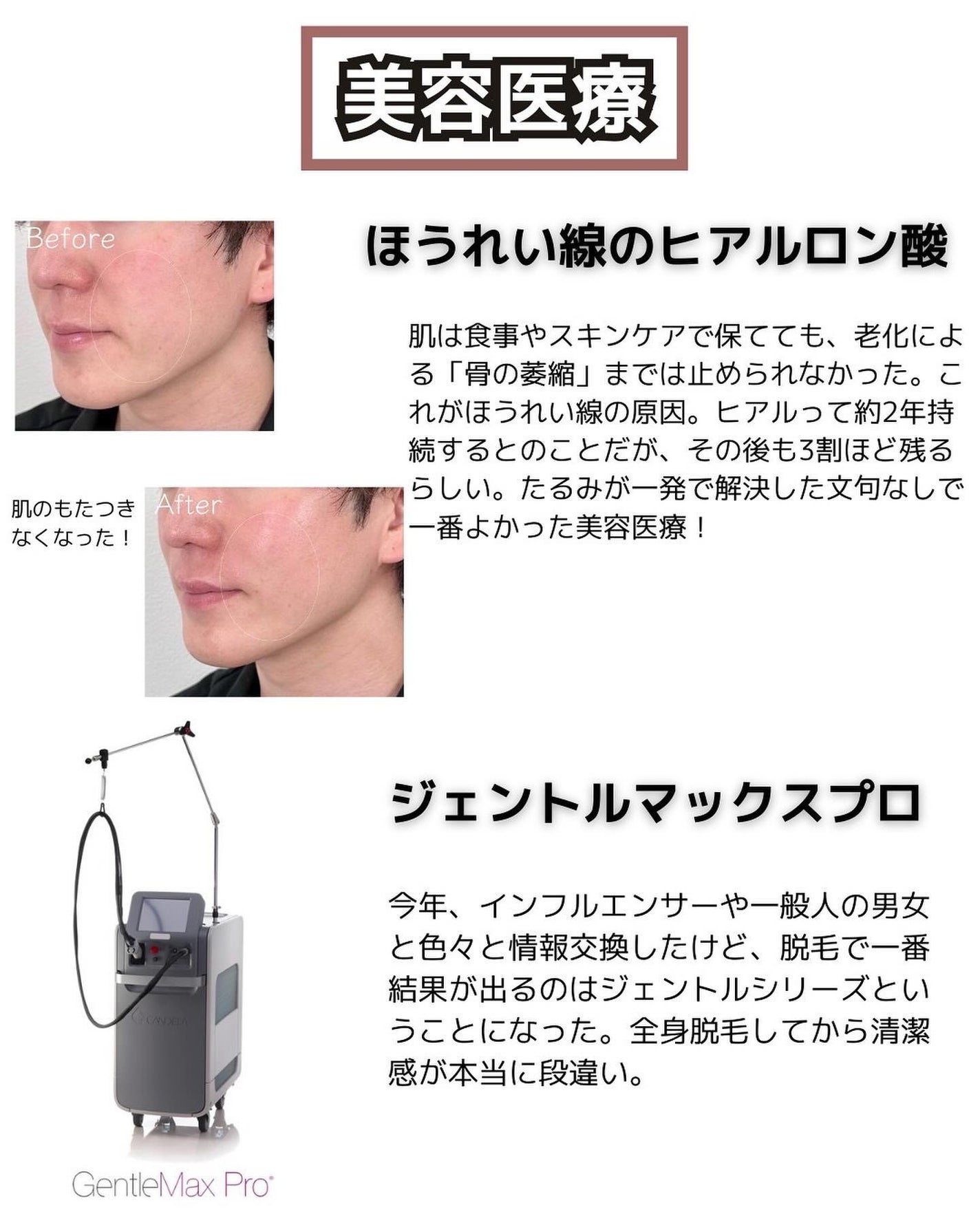 ヒロキ|40歳の美容家 ヘアケア スキンケア on LIPS 「絶対に老けたくない私、38歳になって今までを振り返ってみると結..」(5枚目)