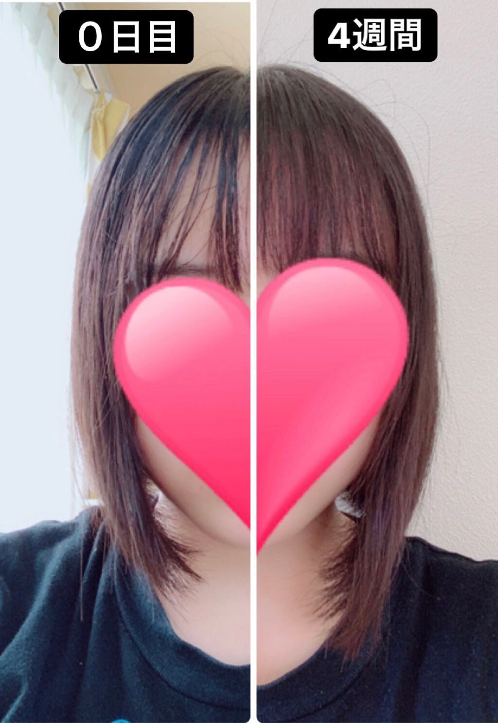 ヘアアクセルレーター フローラルの香り/加美乃素本舗/頭皮ローションを使ったクチコミ(1枚目)