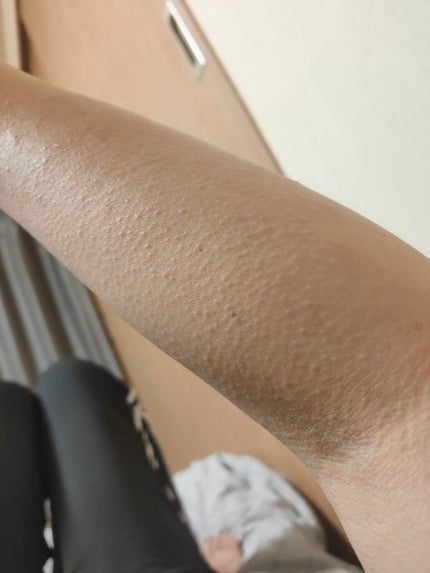 ビオレUV アクアリッチウォータリージェル /ビオレ/日焼け止め・UVケアを使ったクチコミ(3枚目)