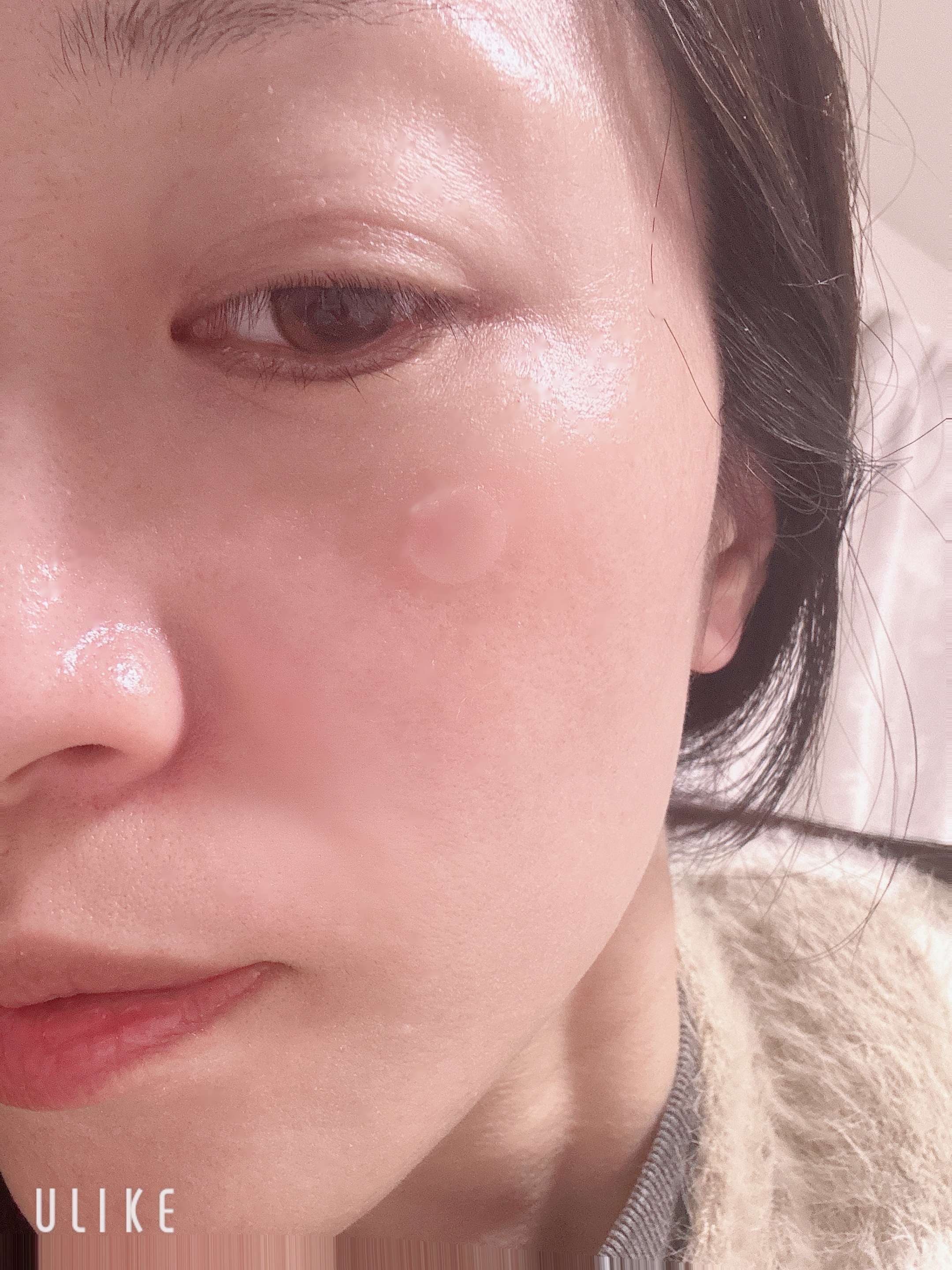 シカバイタルパッチ/VT/その他スキンケアを使ったクチコミ（2枚目）