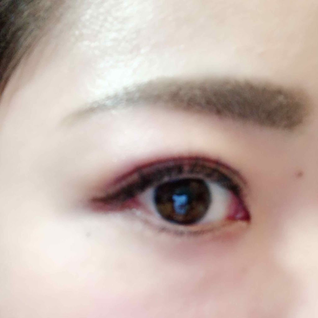 あやりんご🍎 on LIPS 「久々の投稿!!二重整形埋没法をしてから4ヶ月程経ちまして、、、..」(3枚目)