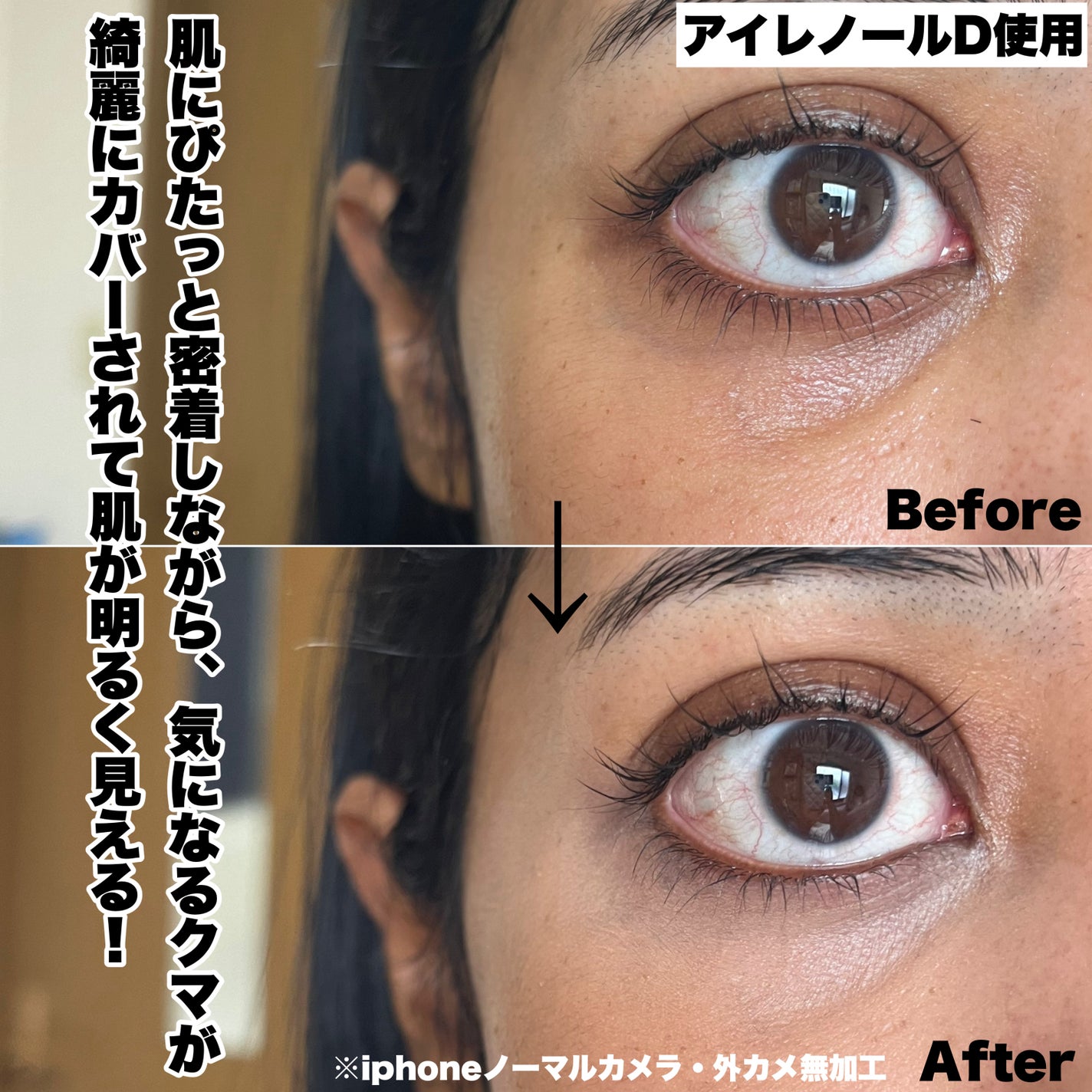 アイレノール クマクリーム/IRENOL/アイケア・アイクリームを使ったクチコミ(5枚目)