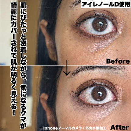 アイレノール クマクリーム/IRENOL/アイケア・アイクリームを使ったクチコミ(5枚目)