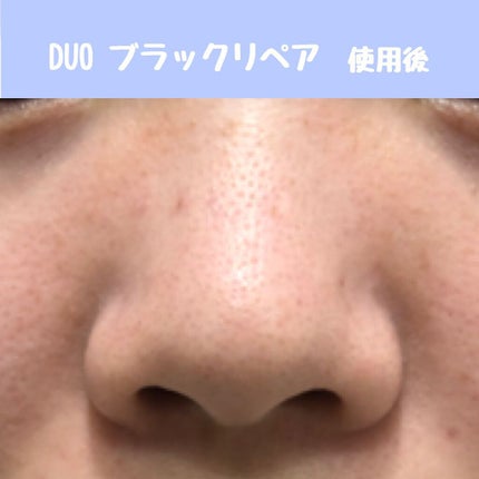 ルルルン クレンジングバーム(アロマタイプ)/ルルルン/クレンジングバームを使ったクチコミ(6枚目)