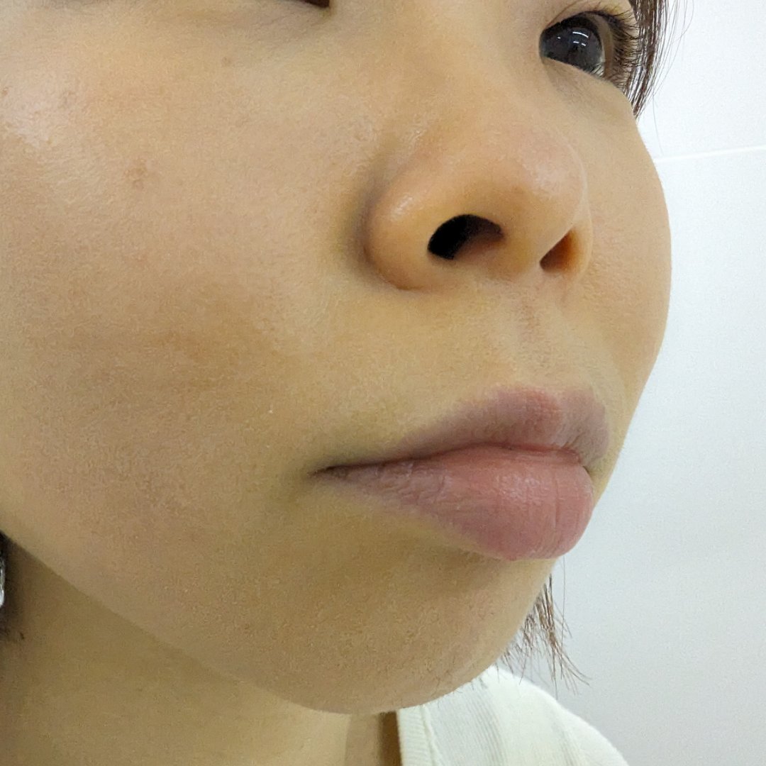 エッセンス スキングロウ ファンデーション 230 Alder/SHISEIDO/リキッドファンデーションを使ったクチコミ（3枚目）