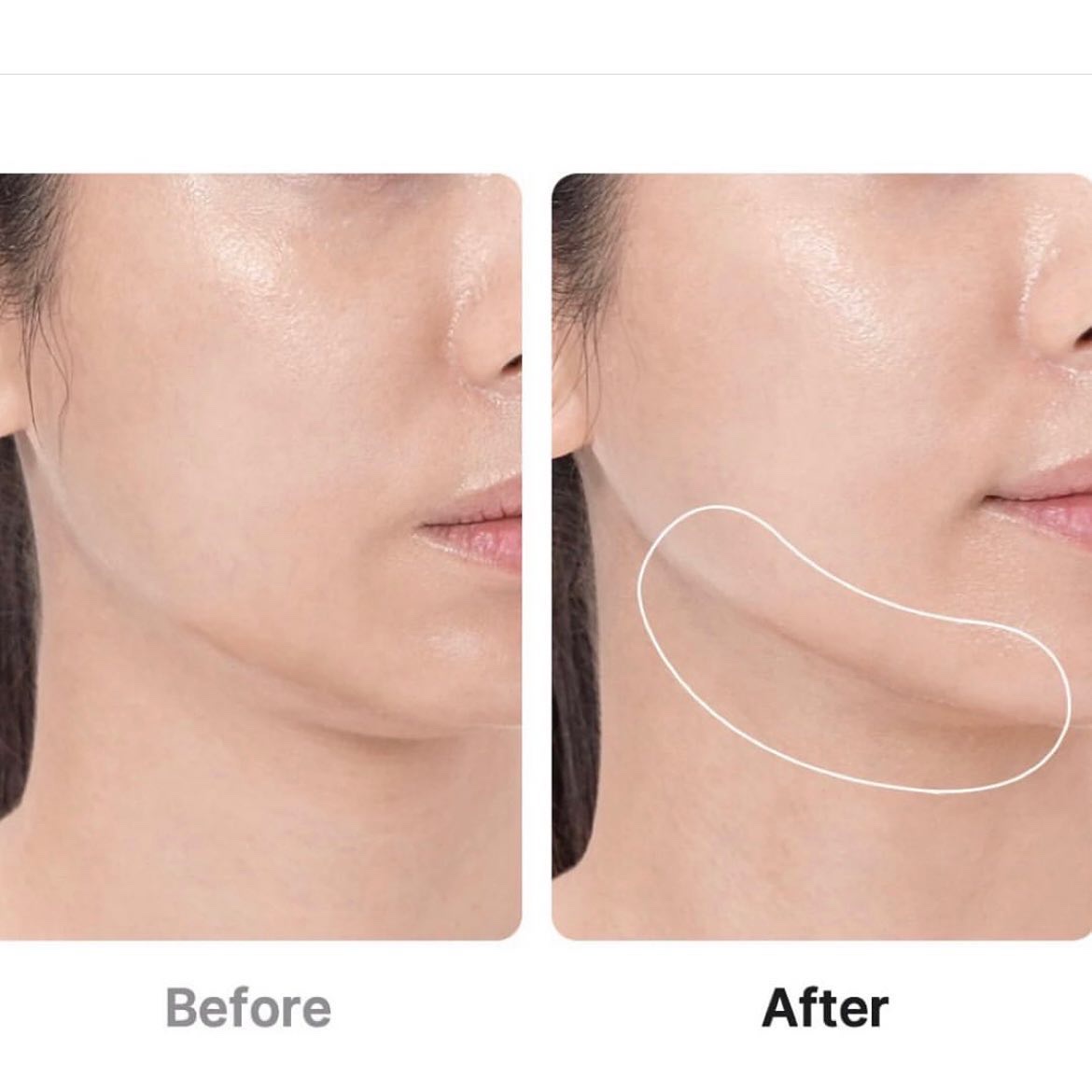 グルタチオングロウアンプル/MEDICUBE/美容液を使ったクチコミ（3枚目）