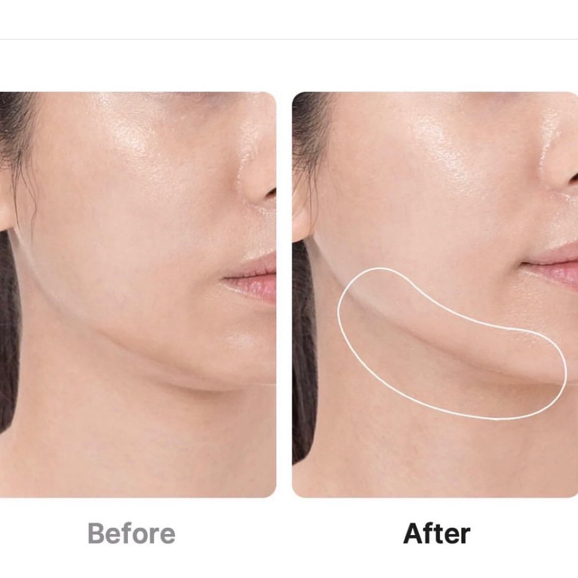 グルタチオングロウアンプル/MEDICUBE/美容液を使ったクチコミ(3枚目)