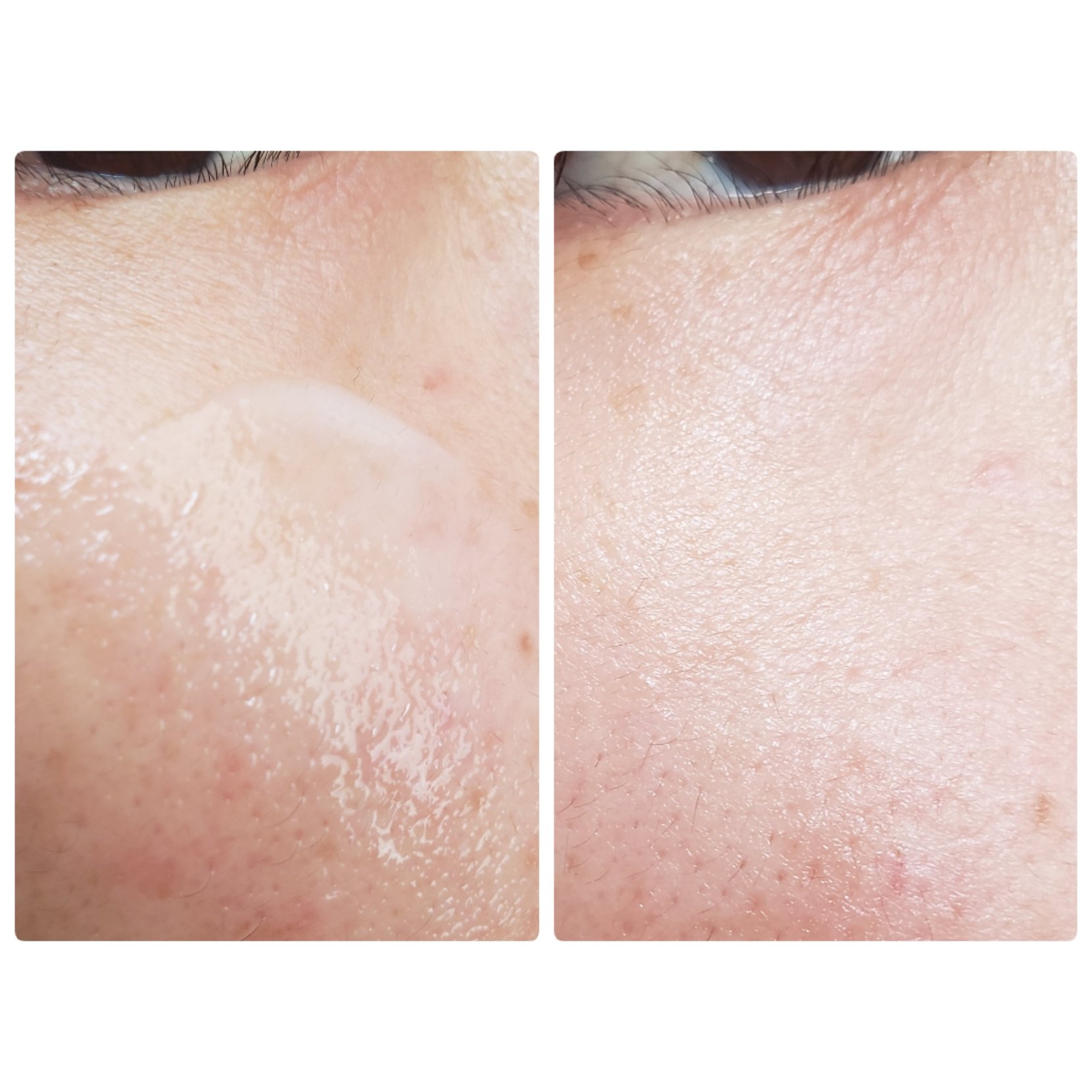 バクチオールポアジェットセラム/Dr.G/美容液を使ったクチコミ（3枚目）