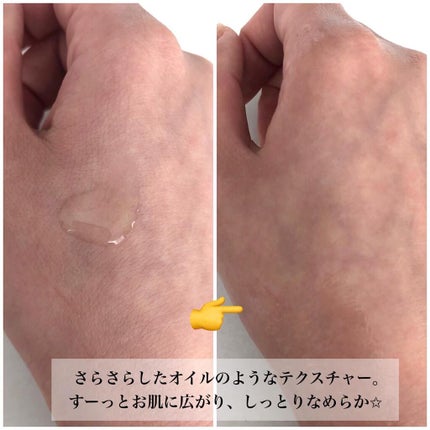 VC ホワイトピールセラム/SKIO/ブースター・導入液を使ったクチコミ(3枚目)