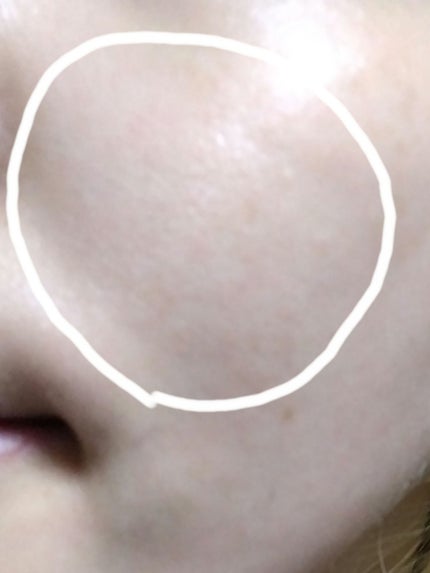 ビタミンレチノールリペアアンプル/BIOHEAL BOH/美容液を使ったクチコミ(5枚目)