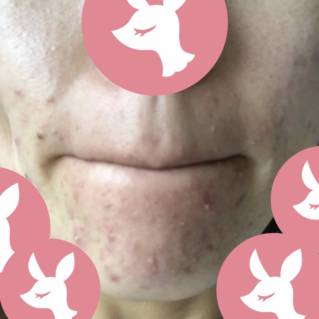 薬用エマルジョン/IHADA/乳液を使ったクチコミ（3枚目）