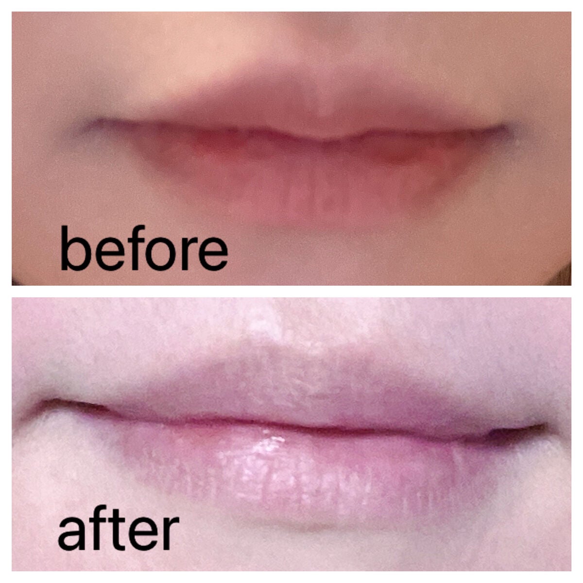 リップエイド集中マスク/トレンドホリック/リップマスクを使ったクチコミ(2枚目)