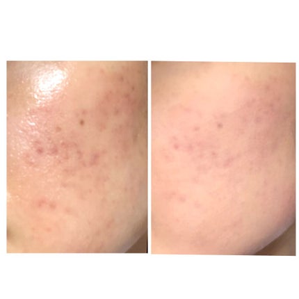 フェイクヌードクリーム/素肌記念日/クリーム・エマルジョンファンデーションを使ったクチコミ(2枚目)