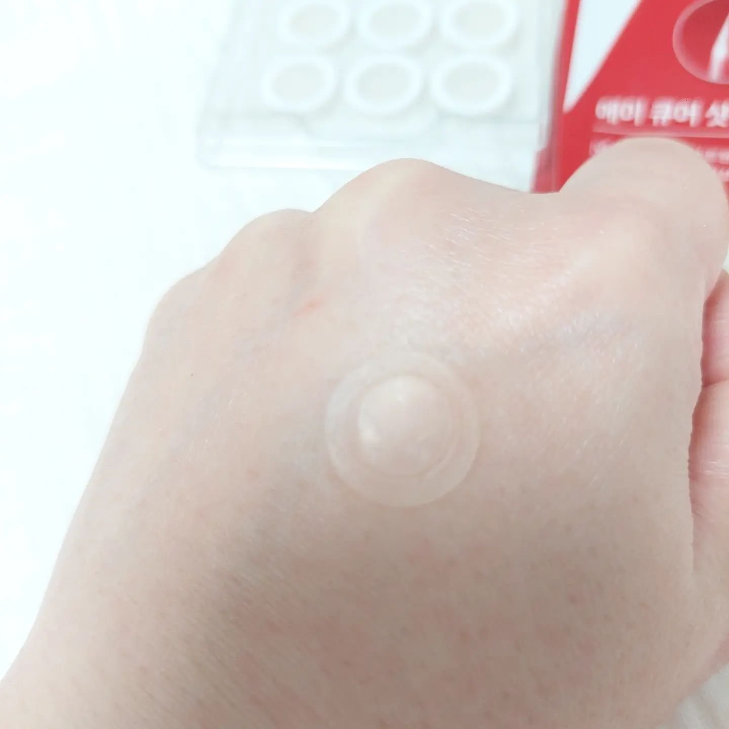 エーキュアショットスポットパッチ/obsero/にきびパッチを使ったクチコミ（3枚目）