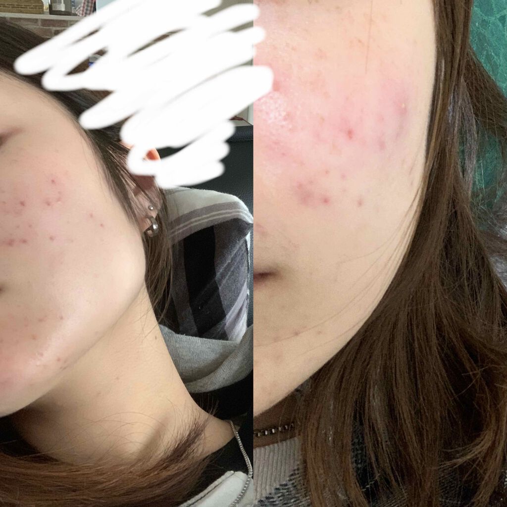 潤浸保湿 フェイスクリーム/キュレル/フェイスクリームを使ったクチコミ（3枚目）