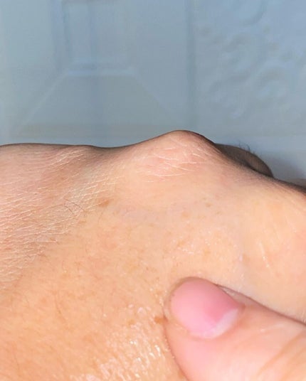 レストレーションセラム/shimaboshi/ブースター・導入液を使ったクチコミ(7枚目)