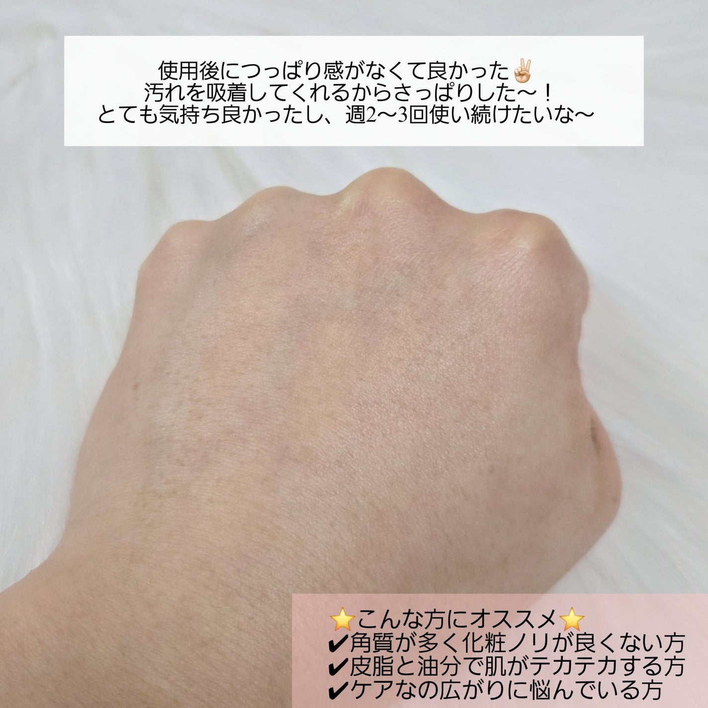 リカバリーマッドマスク/BRMUD/洗い流すパック・マスクを使ったクチコミ(5枚目)