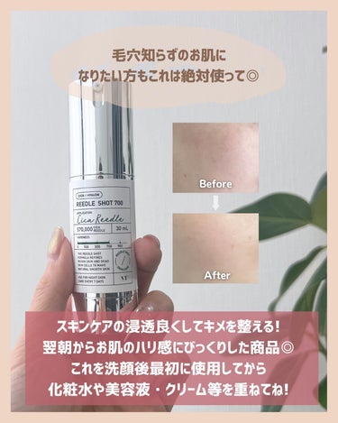 アラサー美容マニア | 化粧品検定1級 on LIPS 「@stay.b_ ◀︎アラサーおすすめコスメはこちら！ハリ肌つ..」（3枚目）