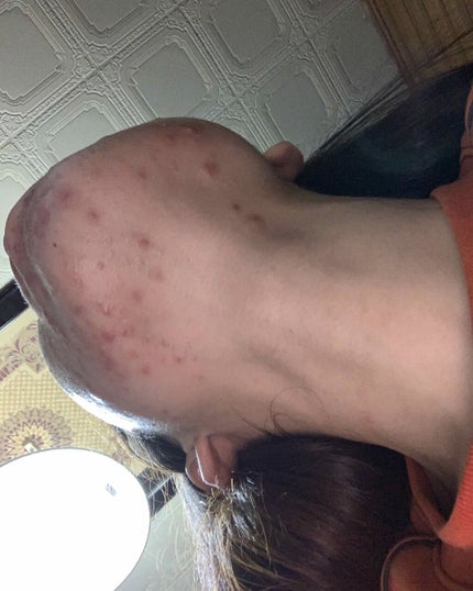 アルソア クイーンシルバー/アルソア/洗顔石鹸を使ったクチコミ(4枚目)