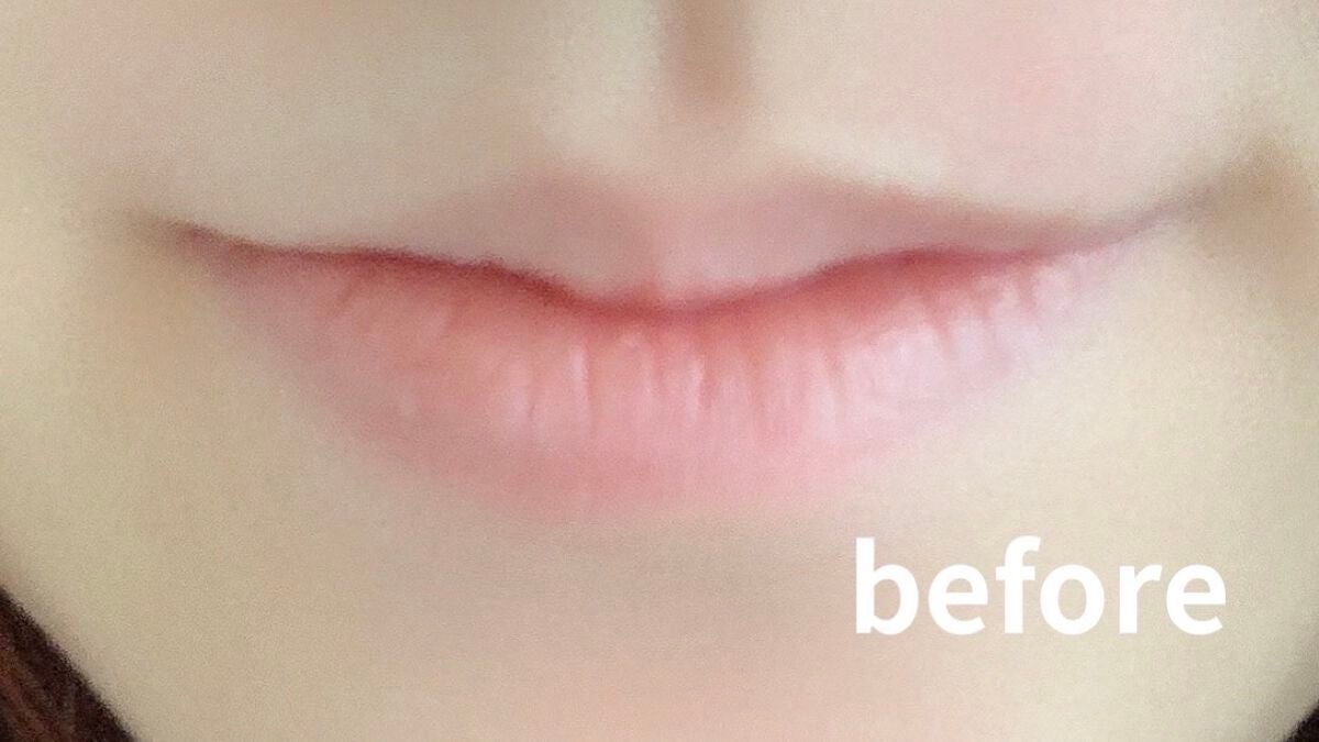 ドトムリッププラスプランパー/keybo/リッププランパーを使ったクチコミ(2枚目)