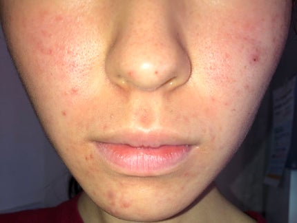 化粧水 敏感肌用 さっぱりタイプ/無印良品/化粧水を使ったクチコミ(3枚目)