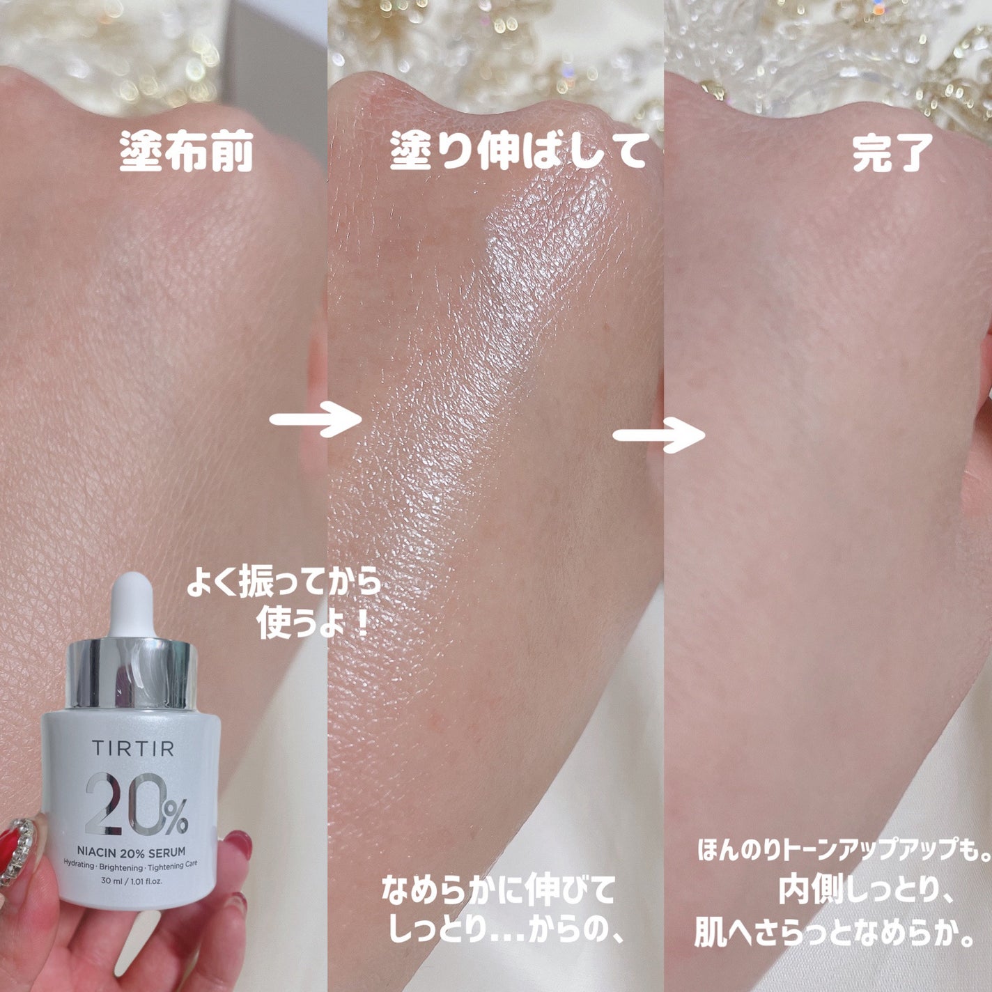 NIACIN 20% セラム/TIRTIR(ティルティル)/美容液を使ったクチコミ(5枚目)