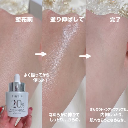 NIACIN 20% セラム/TIRTIR(ティルティル)/美容液を使ったクチコミ(5枚目)