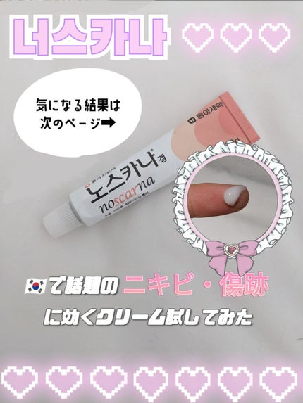 ノスカナゲル/ノスカナゲル/その他スキンケアを使ったクチコミ(1枚目)