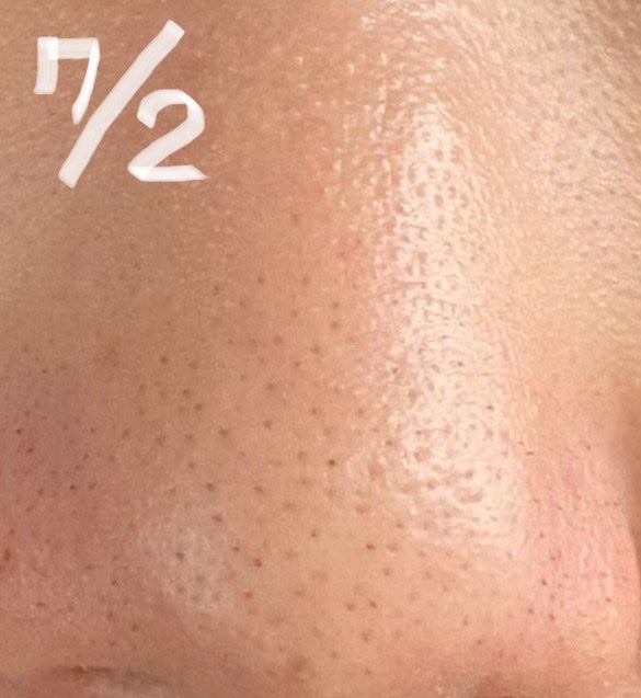 ビューティリフレッシャー/TWANY/その他洗顔料を使ったクチコミ(5枚目)