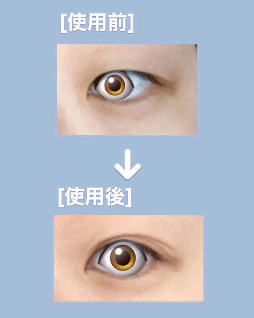 ダブルアイリッド/DAISO/二重まぶた用アイテムを使ったクチコミ(2枚目)