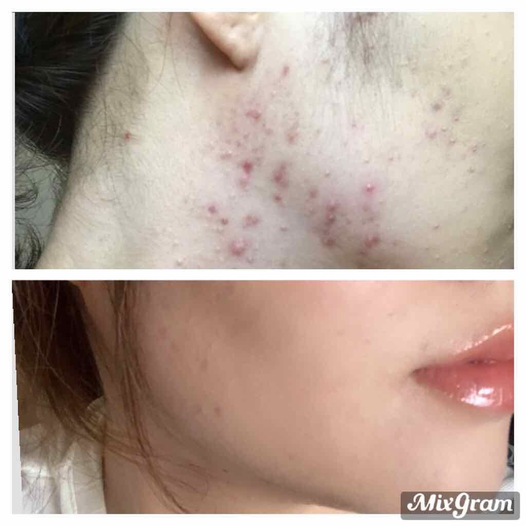 スティックコンシーラー/ファンケル/スティックコンシーラーを使ったクチコミ(2枚目)