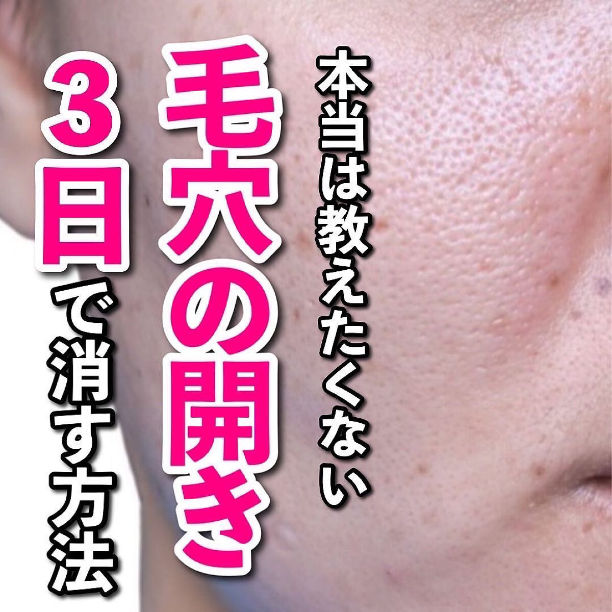 あなたの肌に合ったスキンケア💐コーくん先生 on LIPS 「【本当は教えたくない】毛穴の開き3日で消す方法..あなたの毛穴..」(1枚目)