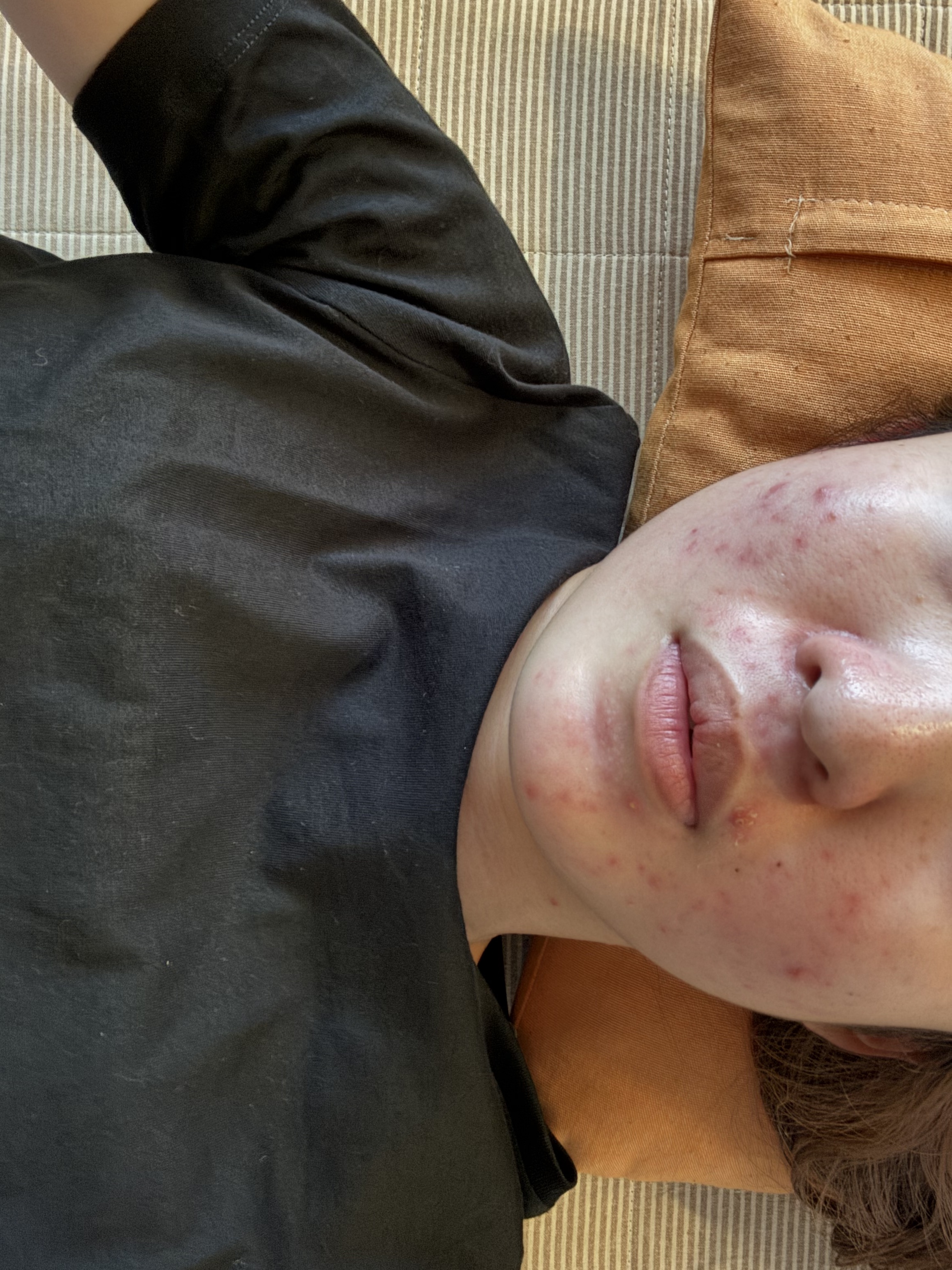 フルフィットプロポリスシナジートナー/COSRX/化粧水を使ったクチコミ（1枚目）