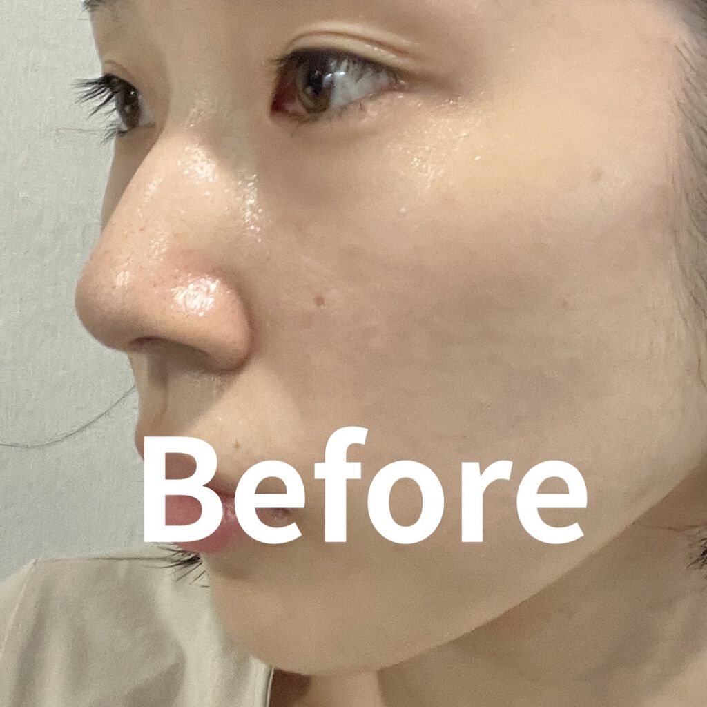 【旧】ディオールスキン フォーエヴァー スキン コレクト コンシーラー/Dior/リキッドコンシーラーを使ったクチコミ（3枚目）