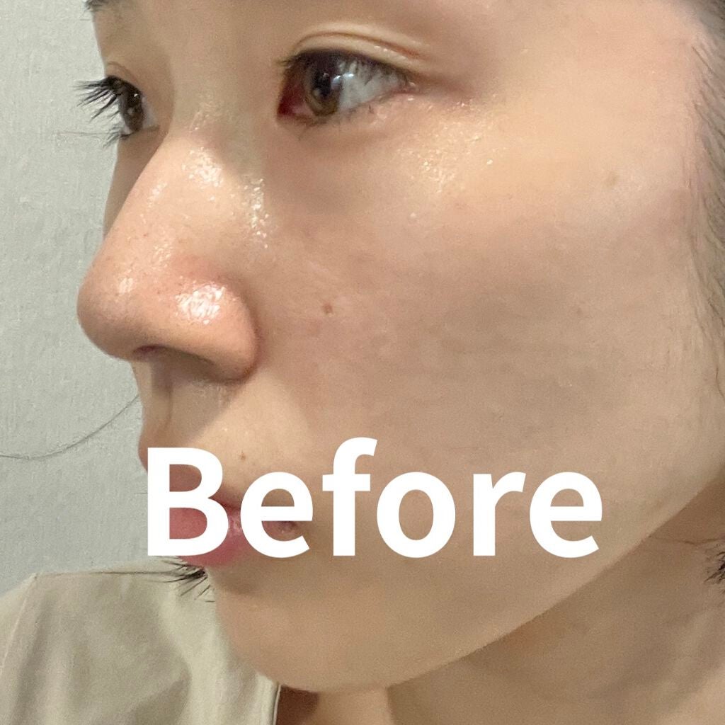 【旧】ディオールスキン フォーエヴァー スキン コレクト コンシーラー/Dior/リキッドコンシーラーを使ったクチコミ(3枚目)