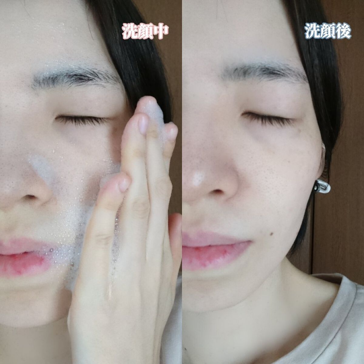 AHA·BHA·PHA 30デイズミラクルアクネボディクレンザー/SOME BY MI/ボディソープを使ったクチコミ(5枚目)