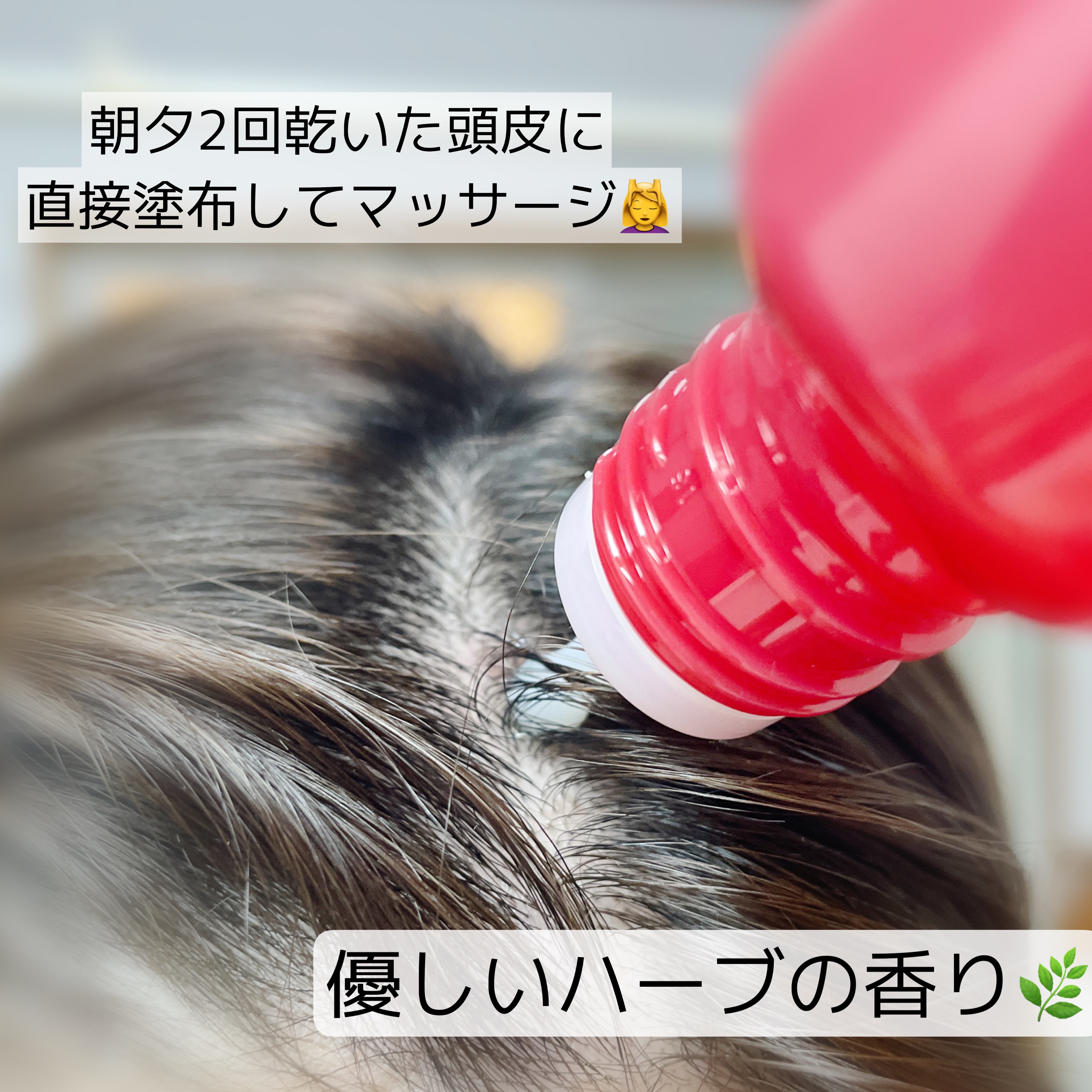 薬用 RJ地肌ケア エッセンス /アピセラピーコスメティクス/頭皮ローションを使ったクチコミ（3枚目）