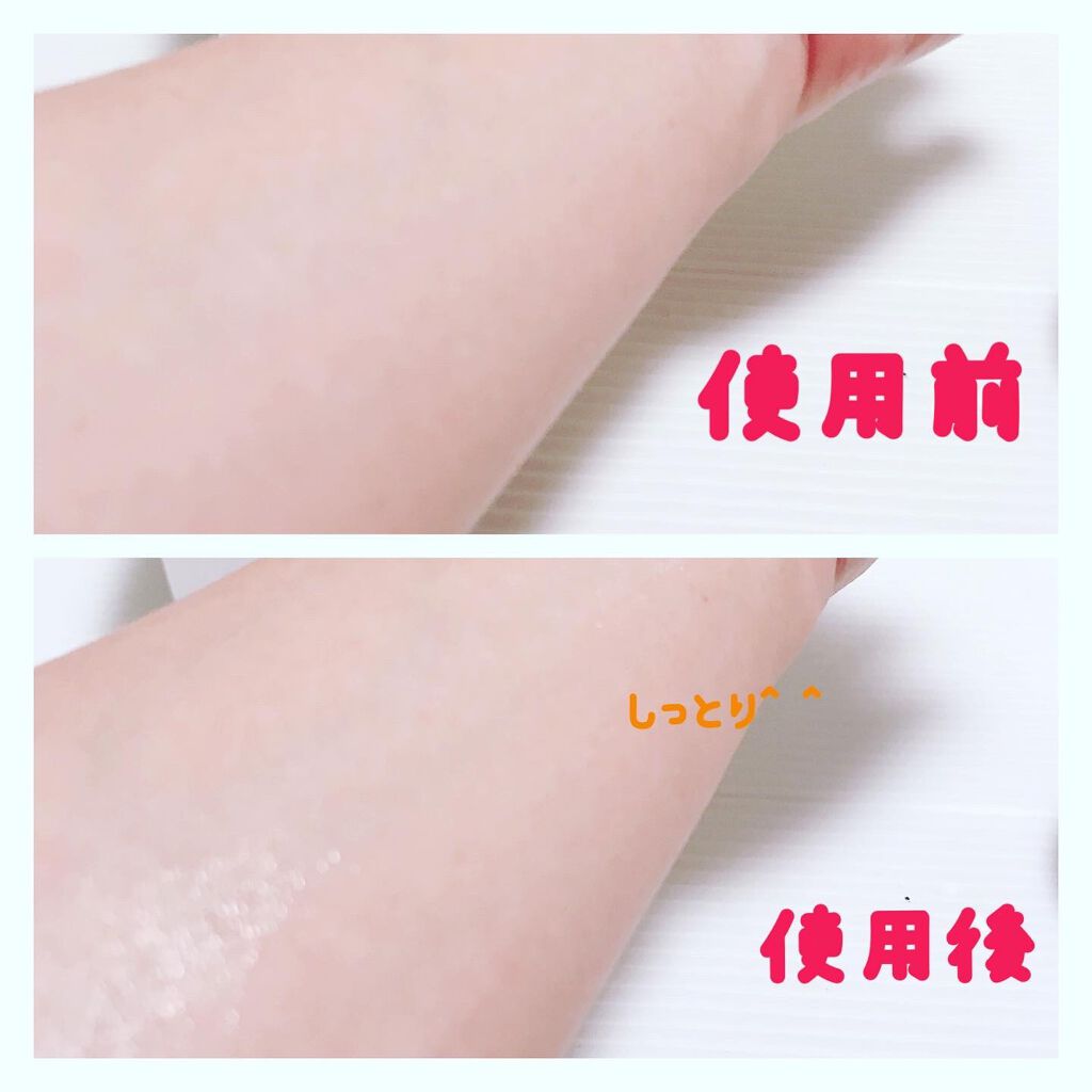 セラムジェル/YELLFOR/美容液を使ったクチコミ(5枚目)