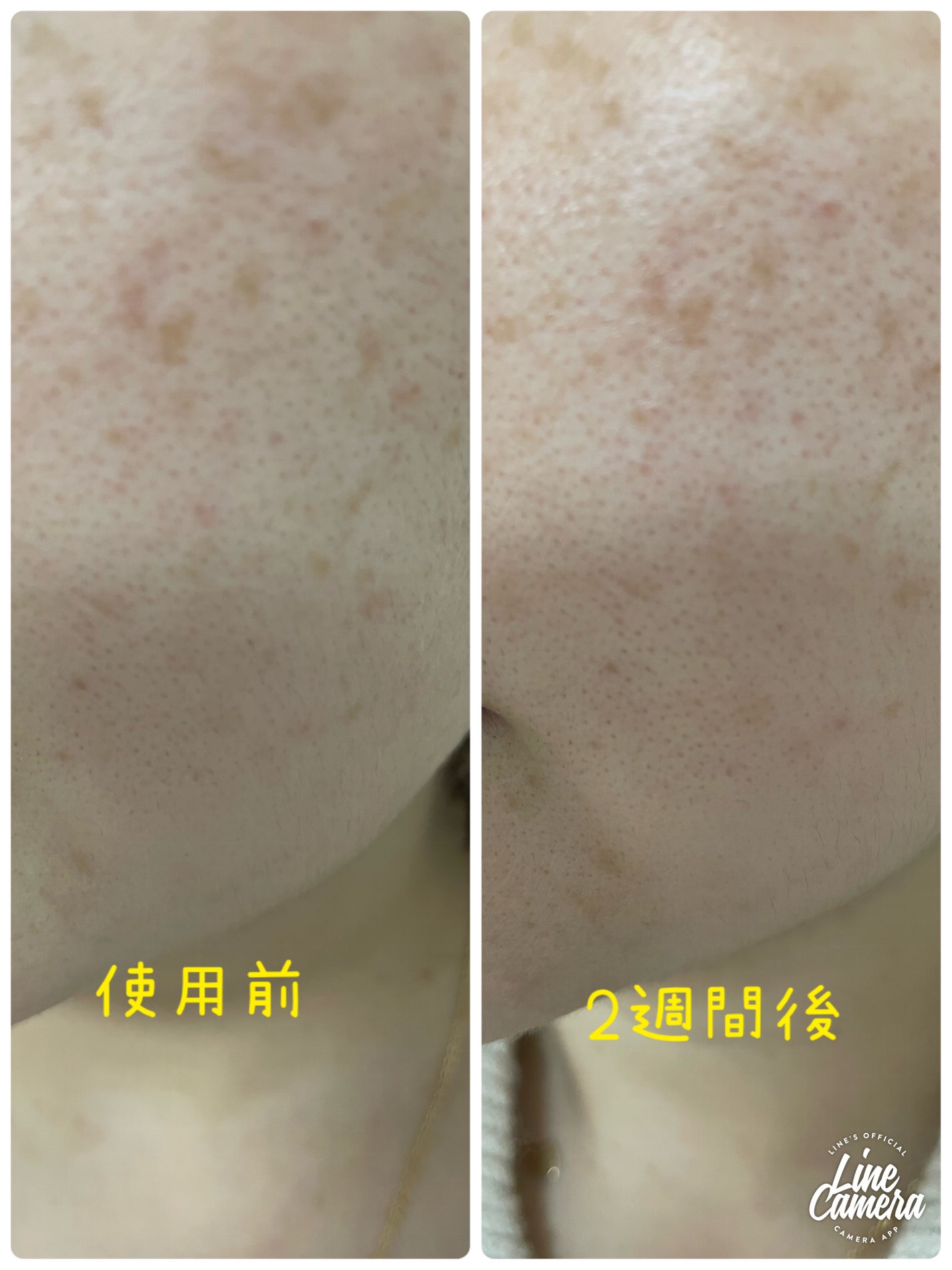 レチノール スーパーバウンス セラム/IOPE/美容液を使ったクチコミ(3枚目)