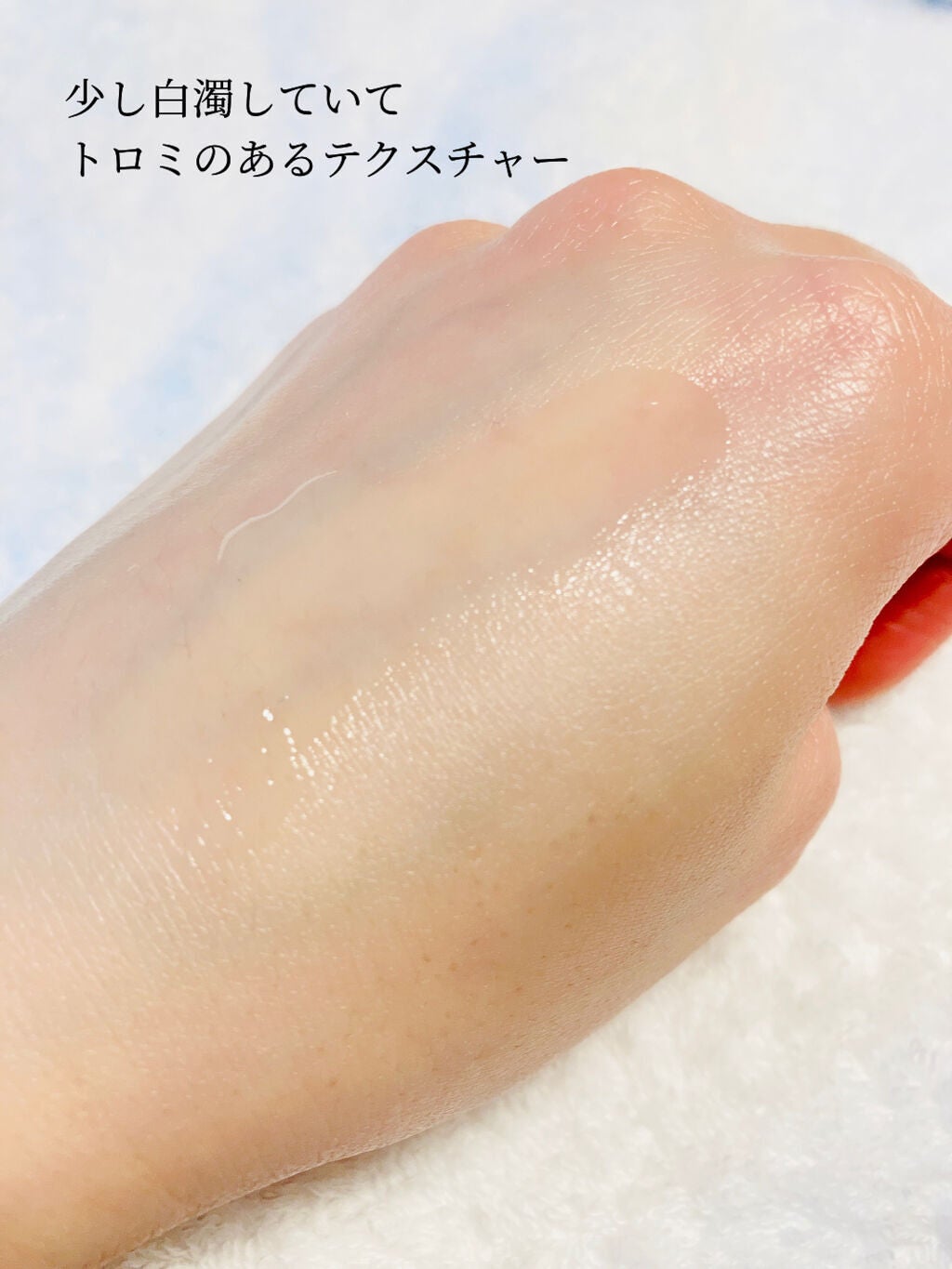 モイスチュア ローション/カルテHD/化粧水を使ったクチコミ(3枚目)