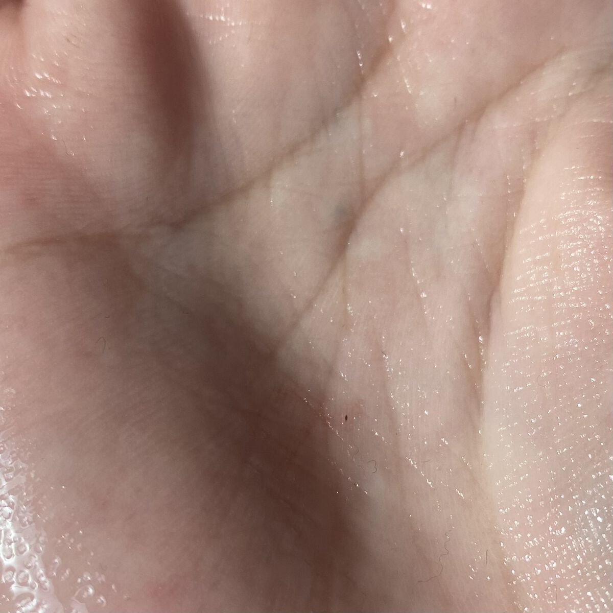 リムヴェール　LSピュア/リムサプライ/美容液を使ったクチコミ（3枚目）