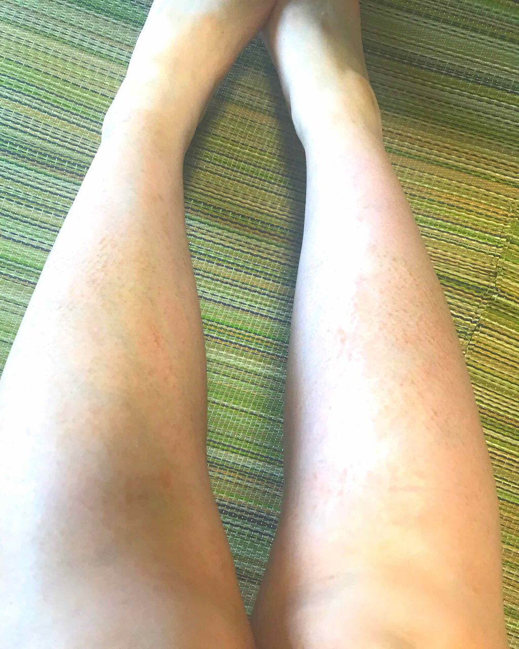 薬用ホワイトコンク ボディシャンプーC II/ホワイトコンク/ボディソープを使ったクチコミ(1枚目)