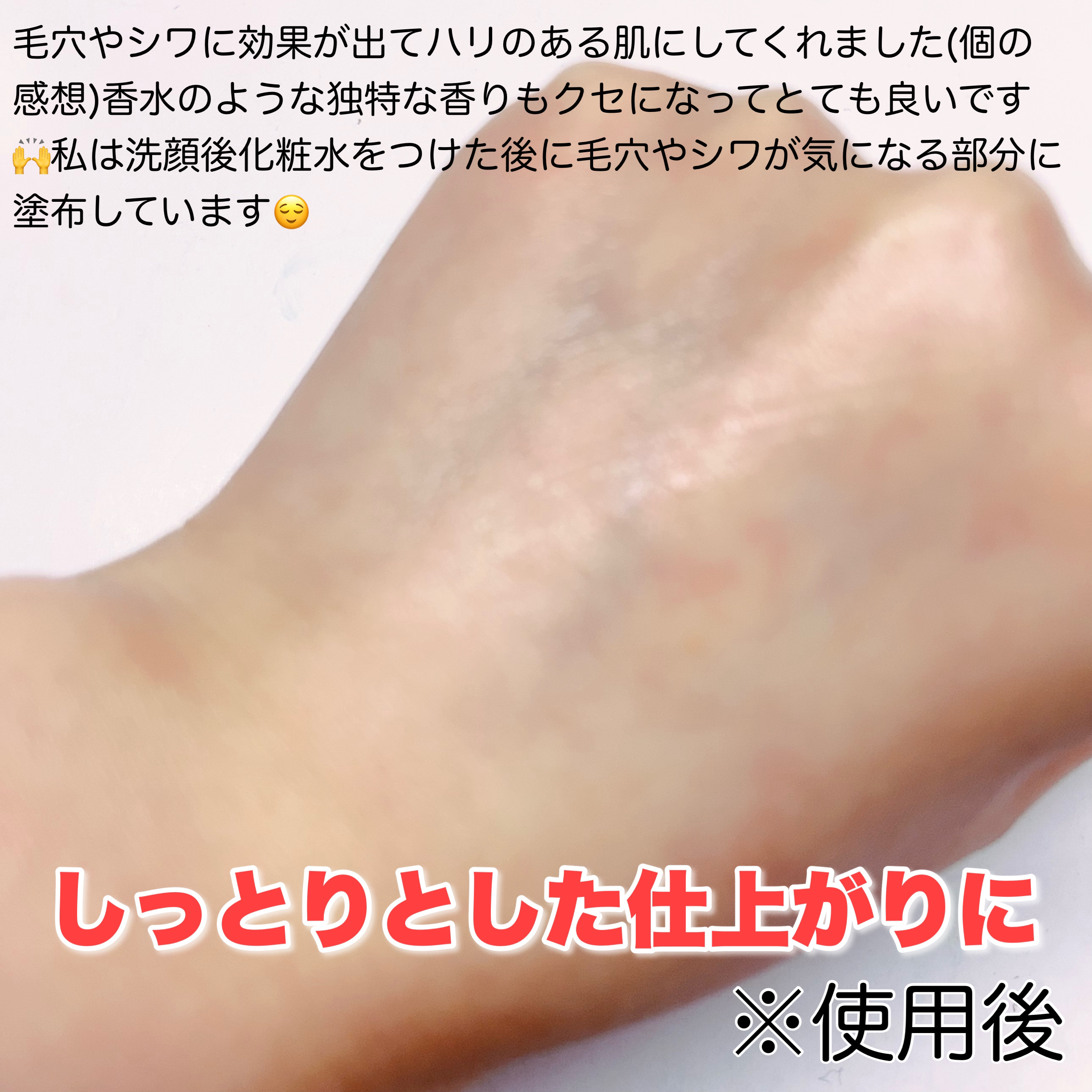 PLACENTREX EXTRACT GEL（ヒトプラセンタジェル）/Placentrex/その他を使ったクチコミ（3枚目）