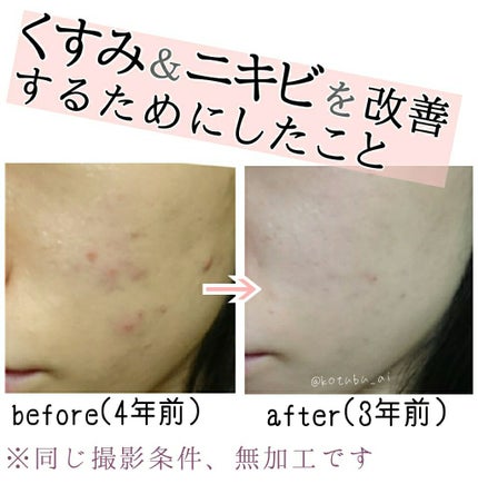 DHC はとむぎエキス/DHC/健康サプリメントを使ったクチコミ(1枚目)