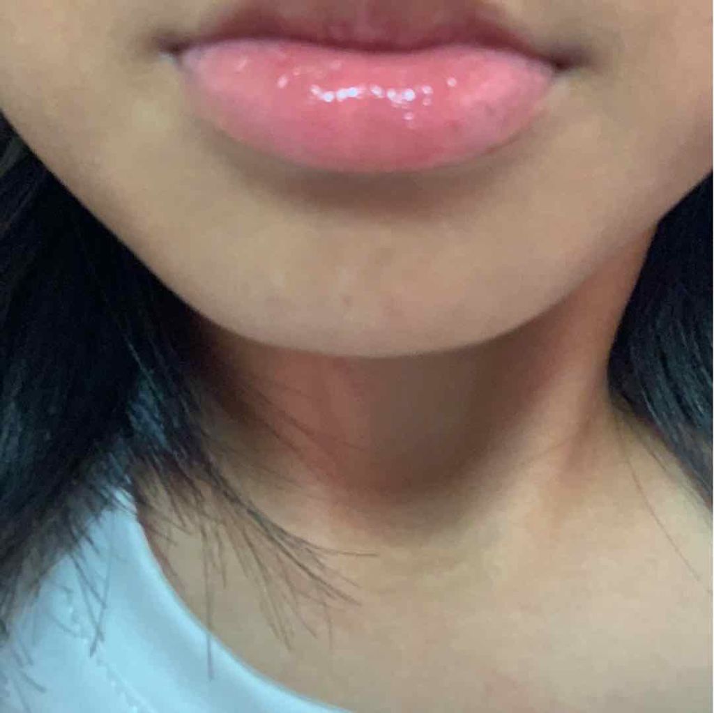 ダーマパワーX リップエッセンス/オバジ/リップ美容液を使ったクチコミ（2枚目）