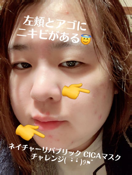 ましろ@風呂キャンQueen on LIPS 「おはようございます☺️※顔の画像ありますー。肌荒れの話なんであ..」(5枚目)