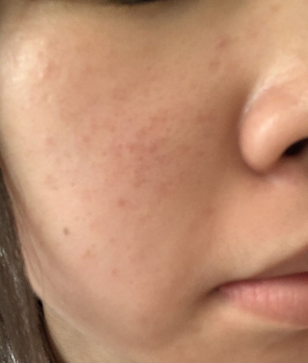 潤浸保湿 乳液/キュレル/乳液を使ったクチコミ（3枚目）